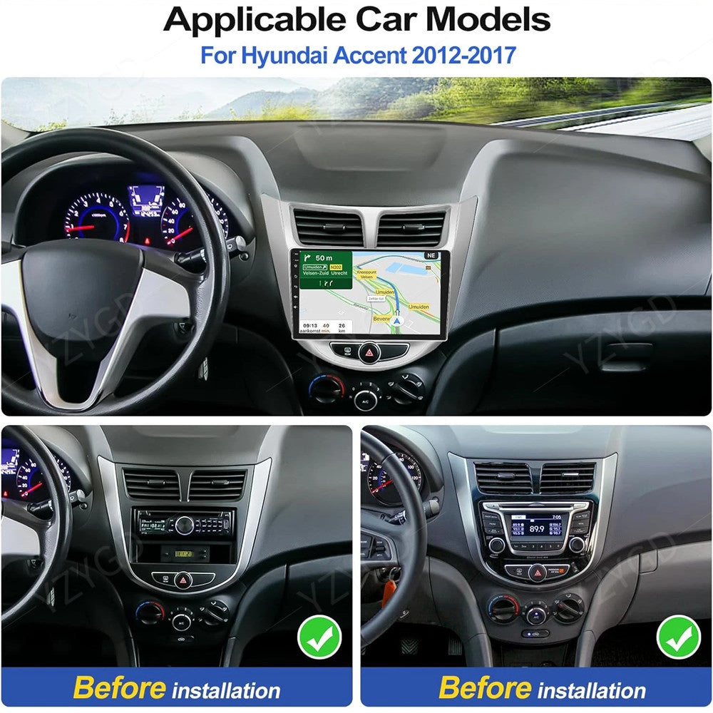 Apple CarPlay for Hyundai Accent 2012-2017 Car Radio Android GPS Stereo Screen